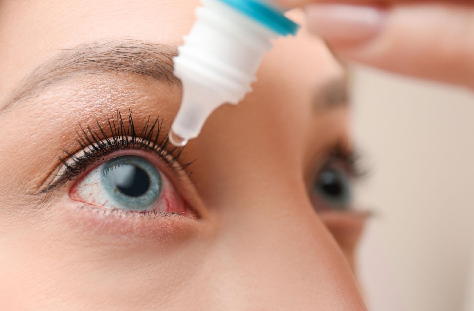 person applying eye drops to relieve dry eye sypmtoms